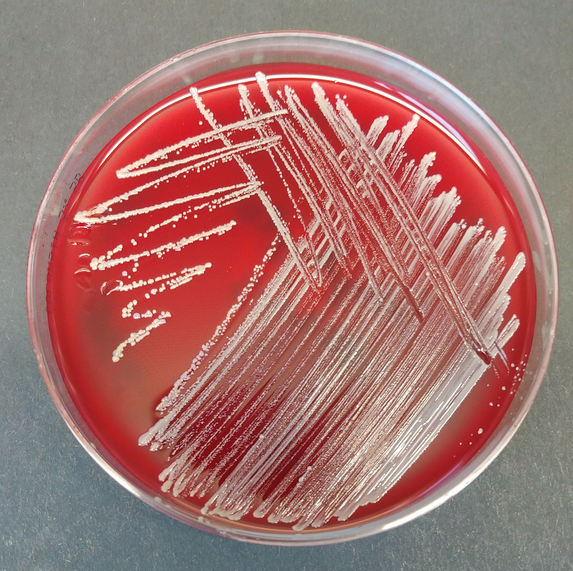 20210616_Staph_plate1.png