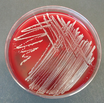20210616_Staph_plate1.png